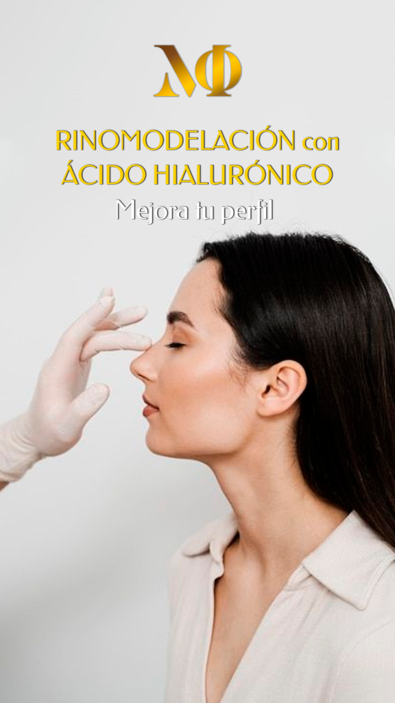 Rinomodelación con Ácido Hialurónico