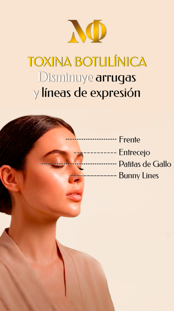 Toxina Botulínica