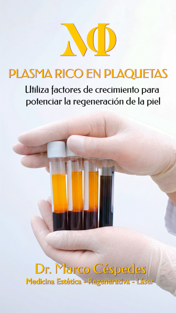 Plasma Rico en Plaquetas (PRP)
